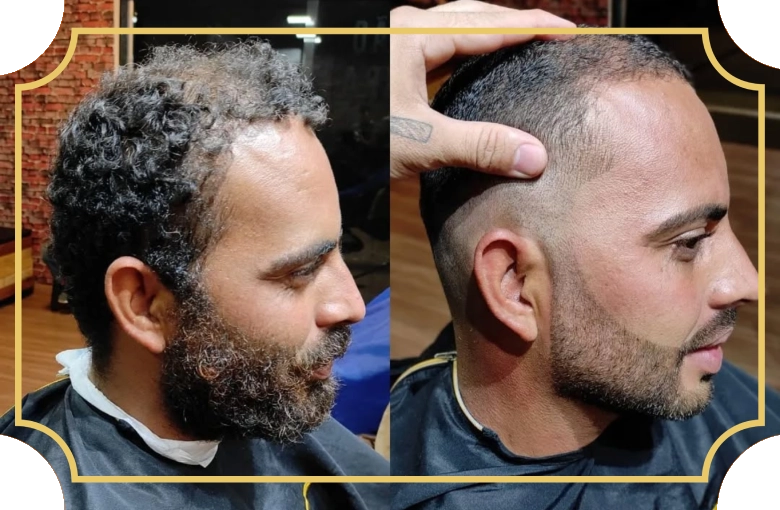 barba-01